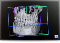 歯科用CT